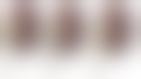 Pyeloplasty Laparoscopic by Posterior approach for difficult to reach PU obstruction PUJO. Dr Aditya