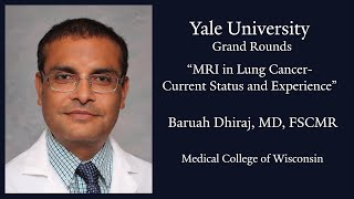 MRI in Lung Cancer - Current Status and Experience