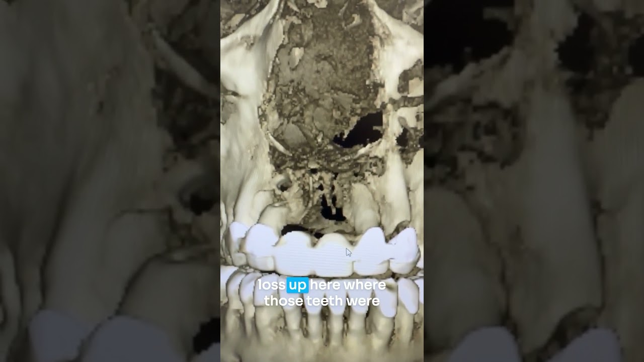 She struggles to breathe...so look what we found on her cone beam ct scan! #shorts