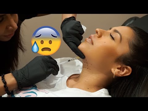ME QUITE LA PAPADA! KYBELLA Mi experiencia - Ydelays