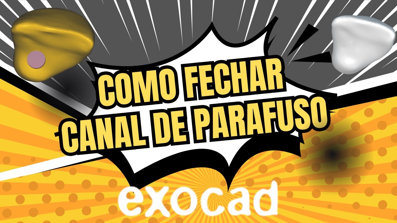 EXOCAD: FECHANDO CANAL DE PARAFUSO