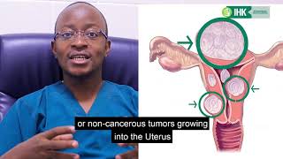 What is Uterine Fibroid Embolization and how is it done? Dr. Hassan Kabiito explains more.