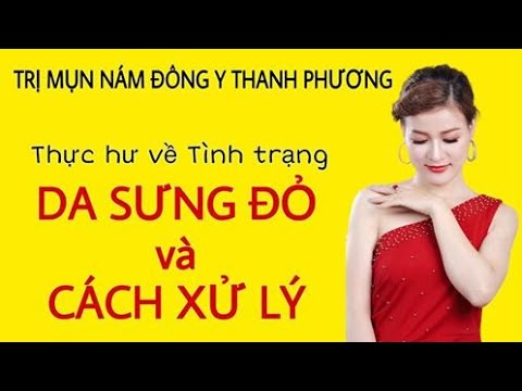 Thực hư chuyện SƯNG DA - ĐỎ DA khi dùng Thuốc Thảo dược Thành phương điều trị Mụn - Nám.