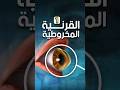 هذا المرض ممكن يدمر نظرك للأبد القرنية المخروطية ضعف النظر فحص العيون عيون الدكتور توفيق