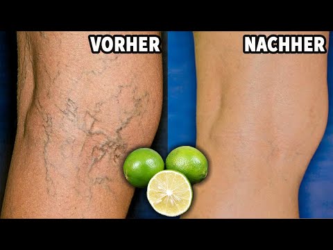 Video: 4 Vergessenes Erbstück Obst Und Gemüse, Das Sie Ihrer Ernährung Hinzufügen Sollten