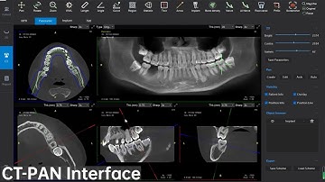 CT PAN Interface, Dental Cone Beam CT software Single function display -- LargeV SmartVPro