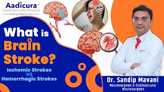 What Is A Brain Stroke? Dr Sandip Mavani Aadicura Superspeciality Hospital