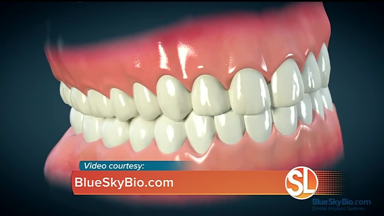 Get new teeth in one day at My Dental Assisting Institute YouTube