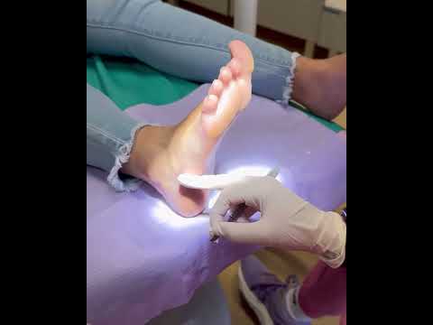 ✨Si ese heloma molesto no te deja caminar cómodo/a, es momento de darle solución 🦶🏽💜