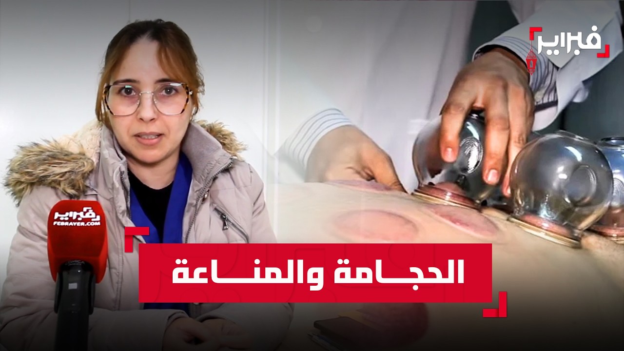 مزاوي تكشف فوائد الحجامة في رمضان وتحذر من ممارستها لدى بعض الفئات