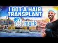 My Turkish Hair Transplant: Estemark Clinic Experience
