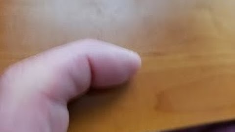 Jammed Finger Treatment With Massage Therapy