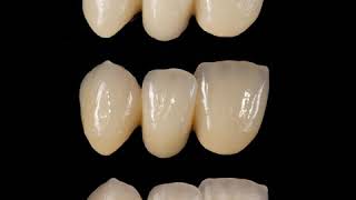 Insync Mc - Metalocerâmica Premium