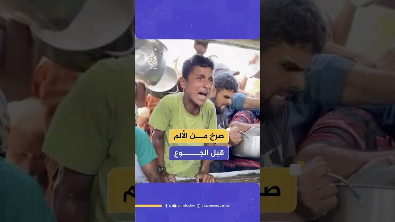 مشاهد مؤلمة لطفل يبكي من الألم بعد سكب الطعام الساخن عليه مما اضطره للاستغناء عن طعامه