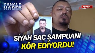 Siyah Saç Şampuanı Kör Ediyordu Beyaz Saçları Kapatmak İçin Şampuan Kullanmak Tehlikeli Mi?