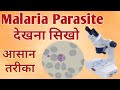 Malaria parasite under microscope | Malaria test | Malaria test procedure