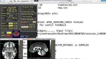 Resting State Analysis, Part IV: Create ROI