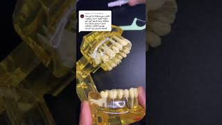 كيف تنظف تركيبات الأسنان الثابتة لمنع الروائح؟