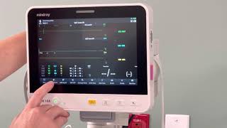 Mindray pre-op/PACU monitors