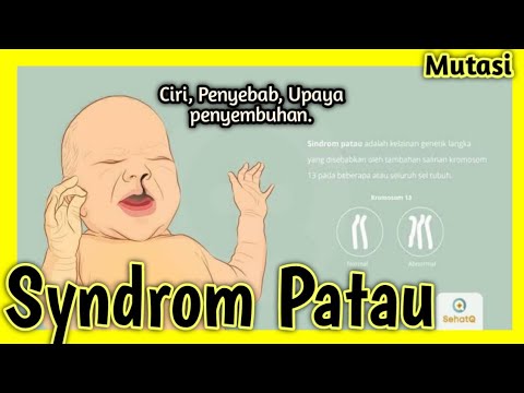 Video: Sindrom Patau - - Penyebab, Gejala Dan Pengobatan