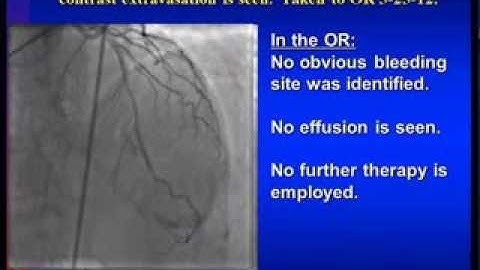 Utilizing FFR and IVUS Guidance