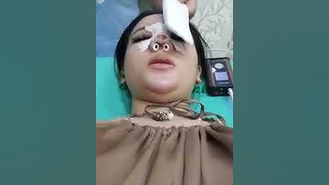 Cảm nhận khách hàng sau khi chiếu Plasma lạnh tại thẩm mỹ Sài Gòn Venus - Chị Tú ngày thứ 2