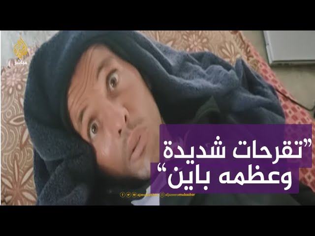 تقرّح وتآكل في أقدامه.. وضع صحي خطير يعانيه الفلسطيني هارون أبو عرام..