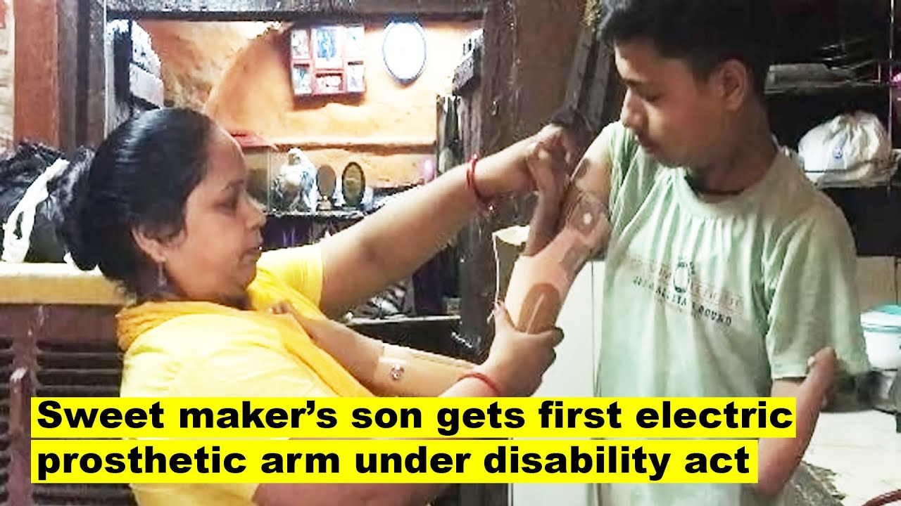 Delhi sweet maker’s son gets first electrically-powered prosthetic arm under disability act