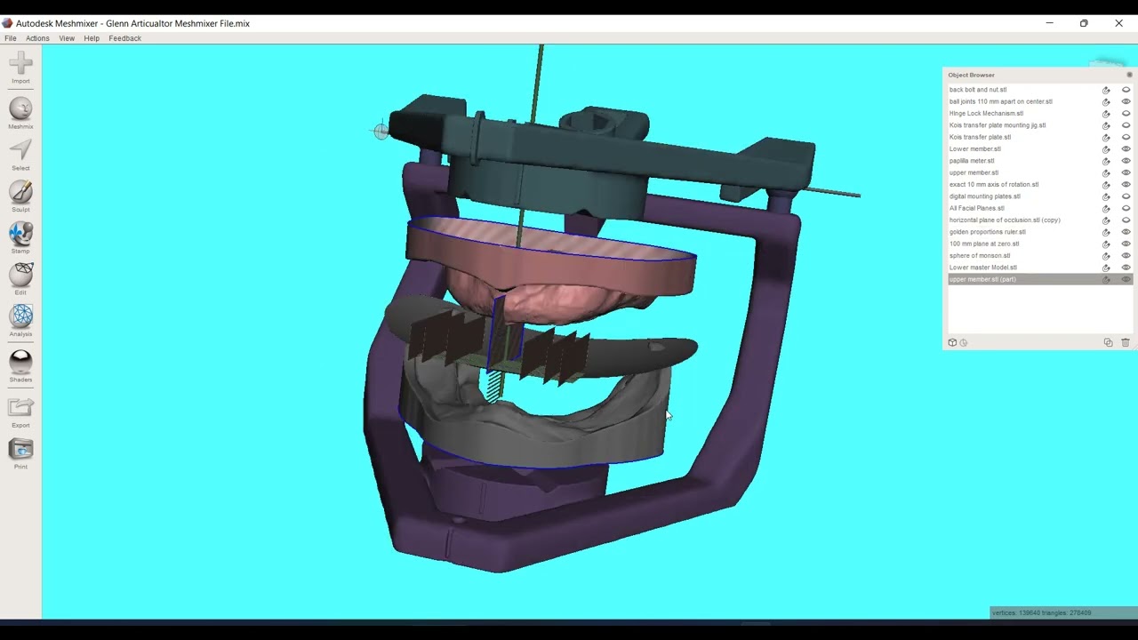 Using the Glenn Articulator Smile Design Tools for a Denture in Exocad