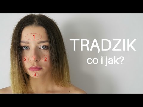 Wideo: Jak Radzić Sobie Z Guzkowym Bólem Trądzikowym