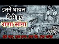 राणा सांगा🗡️ घायल कैसे हुए | Rana sanga real Story🚩#History info#Video