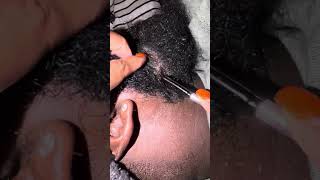 Beard Dandruff Scratching 