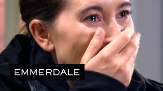 Emmerdale - Ross Reveals What the Acid Has Done to His Face
