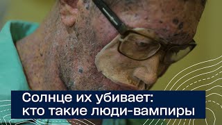 Солнце Их Убивает. Кто Такие Люди-Вампиры. Люди Мутанты