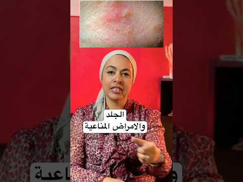 الجلد والاعراض اللي بتظهر عليه مؤشر لأمراض مناعية كتير  روماتويد  الذئبة الحمراء