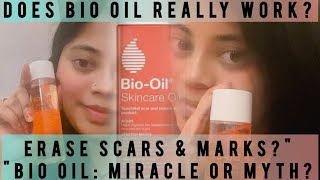 Does Bio Oil Really Work? Honest Review & Demo | Skincare Secrets for Scars, Stretch Marks & Glow