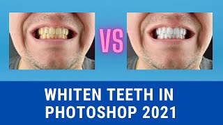How to Whiten Teeth Professionally - Photoshop CC 2021 screenshot 1