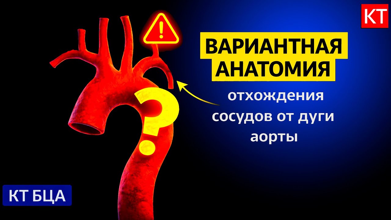 Вариантная анатомия дуги аорты на КТ