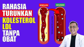 Rahasia Turunkan Kolesterol Jahat (LDL) Secara Alami Tanpa Obat!