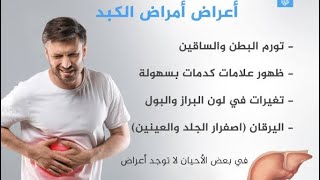 اعراض امراض الكبد