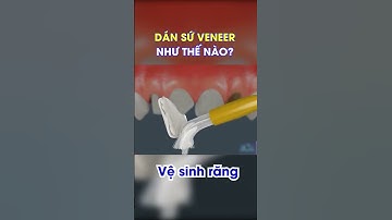Mô phỏng quá trình dán sứ veneer #shorts