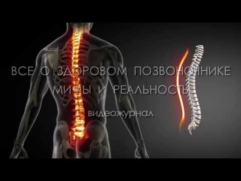 Выпуск №13 Радикулит