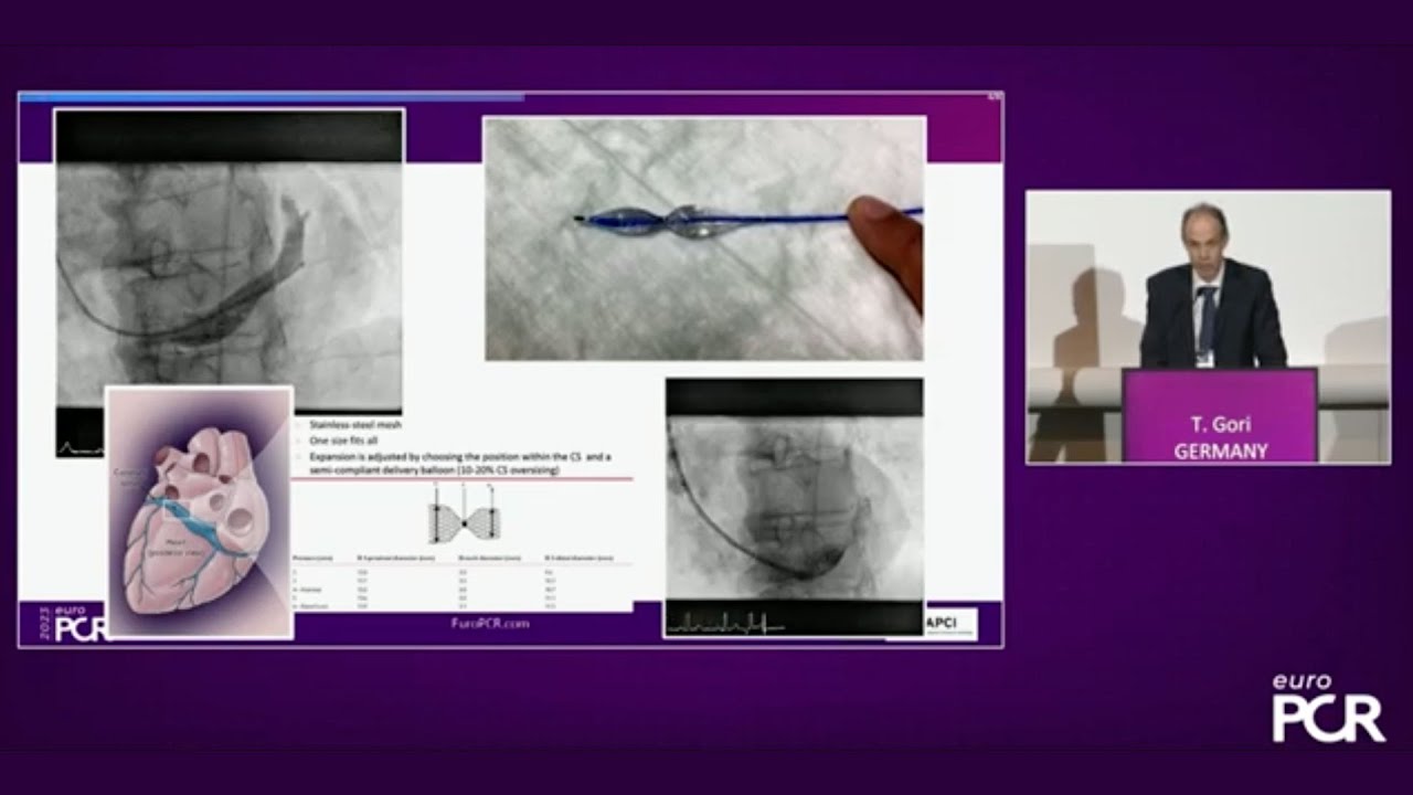 Treating Refractory Angina Patients With Obstructive And Non Treating refractory angina patients with obstructive and non
