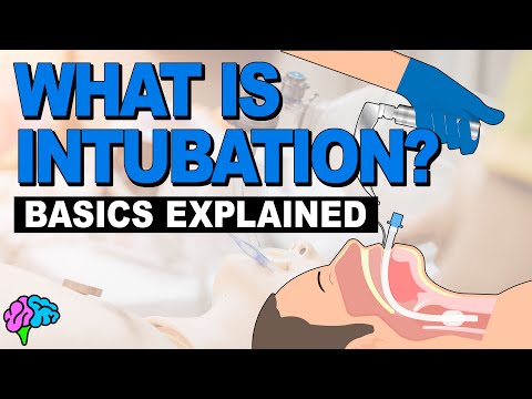 Video: Ce este intubat în icu?