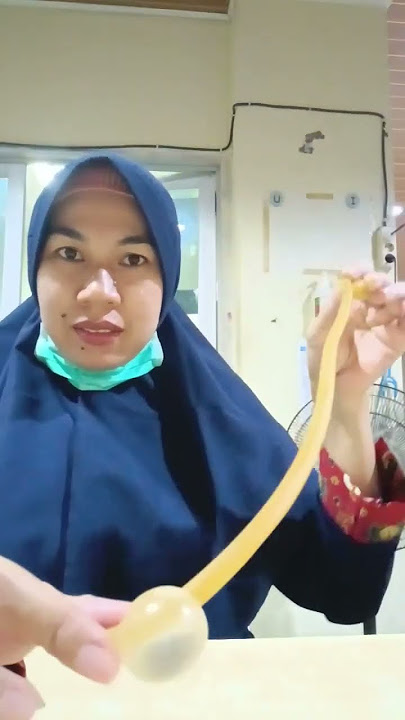 Kenapa selang Kateter Tidak lepas saat mengedan?? #shortvideo #shorts #perawatcantik