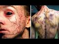 Top 10 Medical Cases Doctors Couldn’t Explain