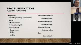 Principles of fracture fixation Dr Musab Elgalli screenshot 5