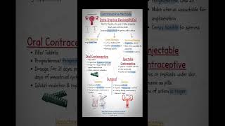 Contraceptive Methods Explained 💊 | IUD, Pills, Injectables &amp; Surgery|#nursingstudent#medicalshorts