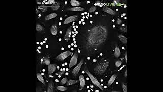 Holotomographic imaging of T cells and cancer cells in co-culture