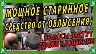 МОЩНОЕ ПРОВЕРЕННОЕ СРЕДСТВО ОТ ОБЛЫСЕНИЯ/ВОЛОСЫ РАСТУТ ДАЖЕ НА ЛЫСИНЕ.🧙‍♂️